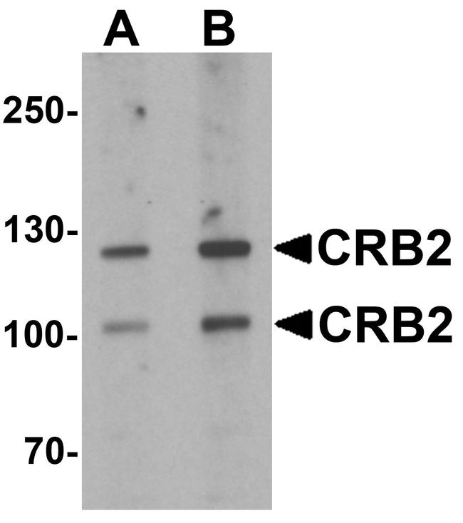 CRB2 Antibody in Western Blot (WB)