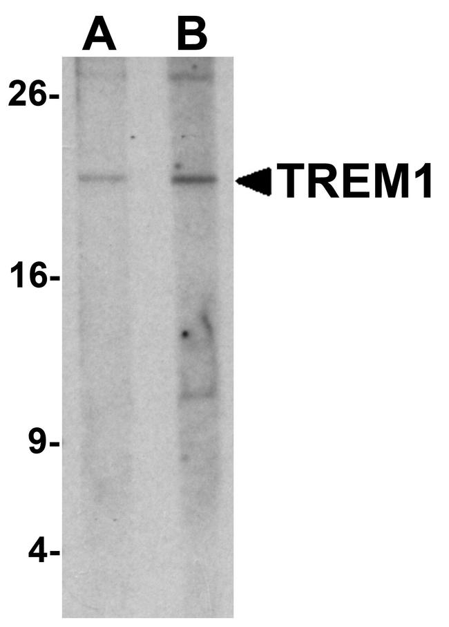 TREM1 Antibody in Western Blot (WB)