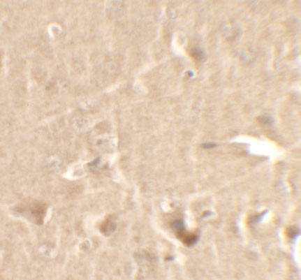 Cyclin T1 Antibody in Immunohistochemistry (IHC)