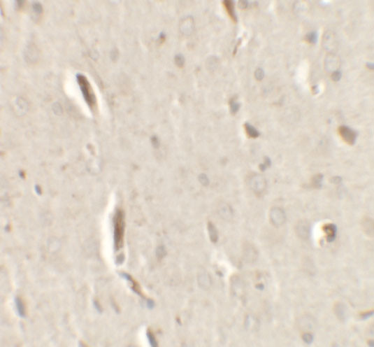 GRIP1 Antibody in Immunohistochemistry (IHC)
