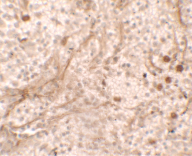PIBF1 Antibody in Immunohistochemistry (IHC)