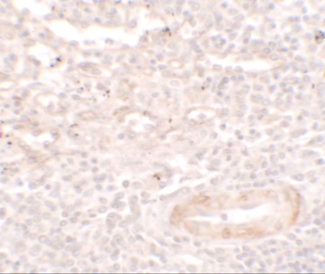 SDPR Antibody in Immunohistochemistry (IHC)