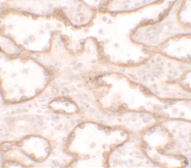 PTRF Antibody in Immunohistochemistry (IHC)