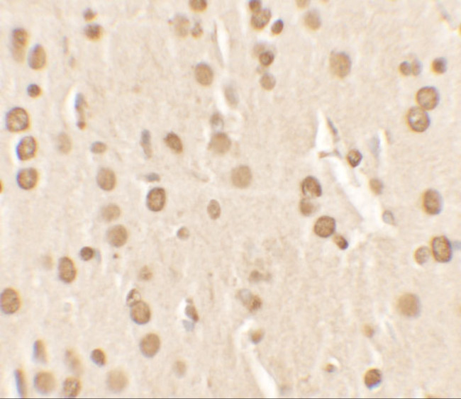 NUCB2 Antibody in Immunohistochemistry (IHC)