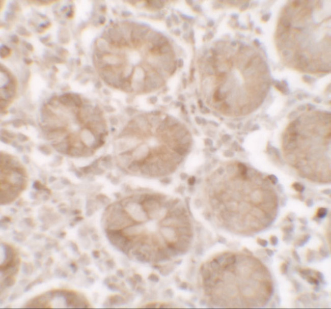 SHISA3 Antibody in Immunohistochemistry (IHC)