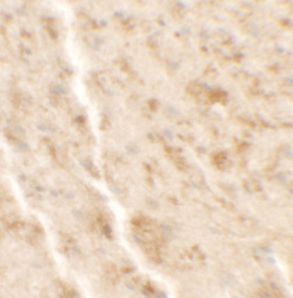 SHISA4 Antibody in Immunohistochemistry (IHC)