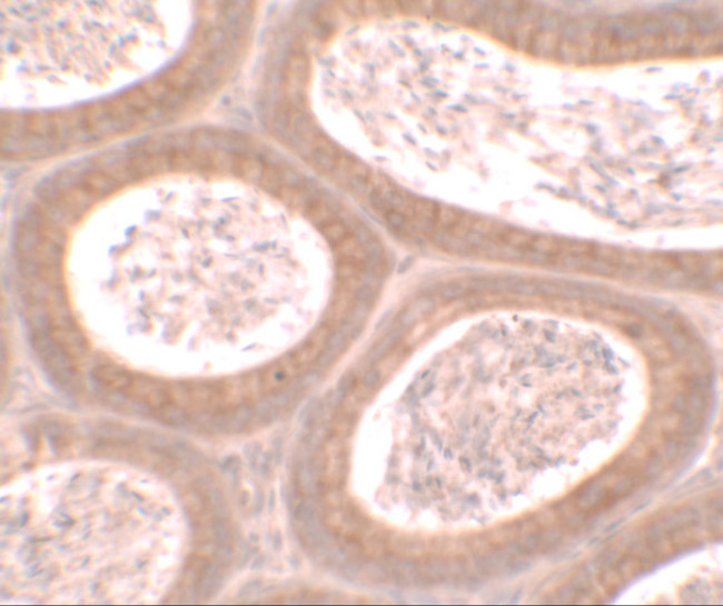 MOSPD1 Antibody in Immunohistochemistry (IHC)