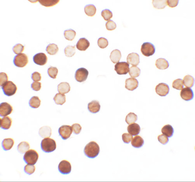 ERRF Antibody in Immunocytochemistry (ICC/IF)