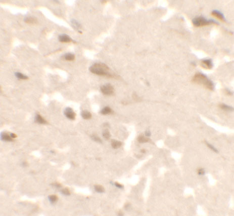 ULK2 Antibody in Immunohistochemistry (IHC)