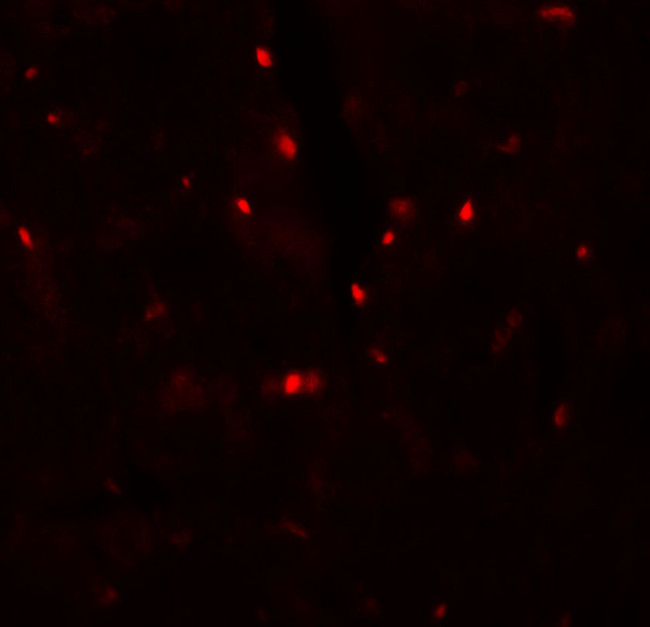 SLC27A6 Antibody in Immunohistochemistry (IHC)
