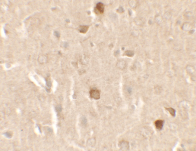CNRIP1 Antibody in Immunohistochemistry (IHC)