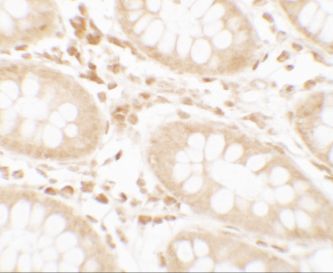 Torc2 Antibody in Immunohistochemistry (IHC)