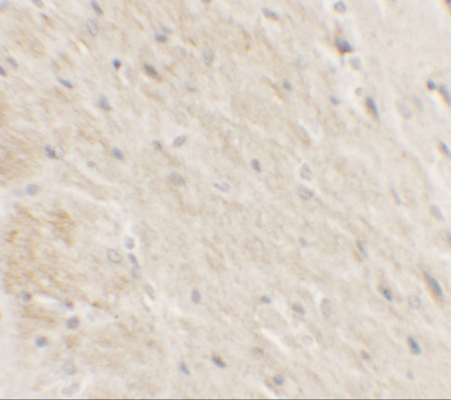 DDX41 Antibody in Immunohistochemistry (IHC)