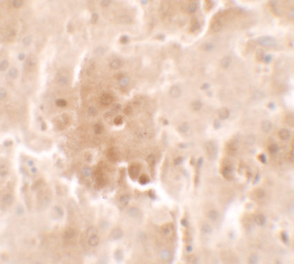 RNF20 Antibody in Immunohistochemistry (IHC)