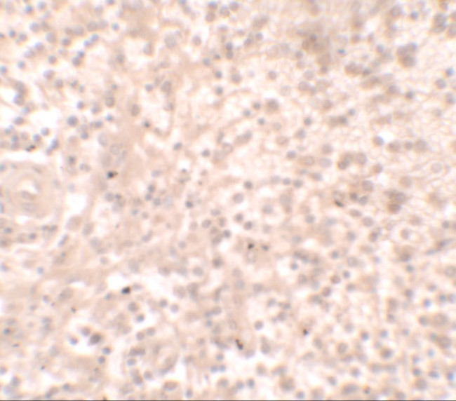 TLX1 Antibody in Immunohistochemistry (IHC)
