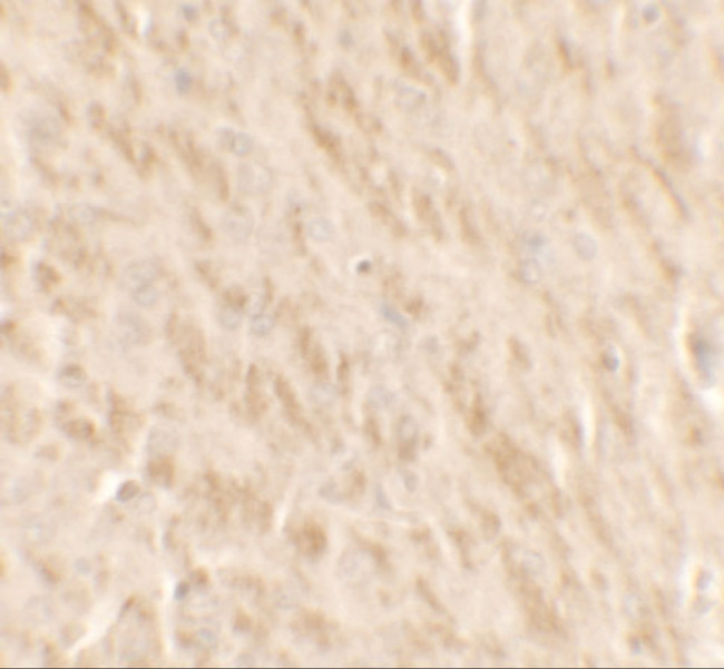 TLX2 Antibody in Immunohistochemistry (IHC)