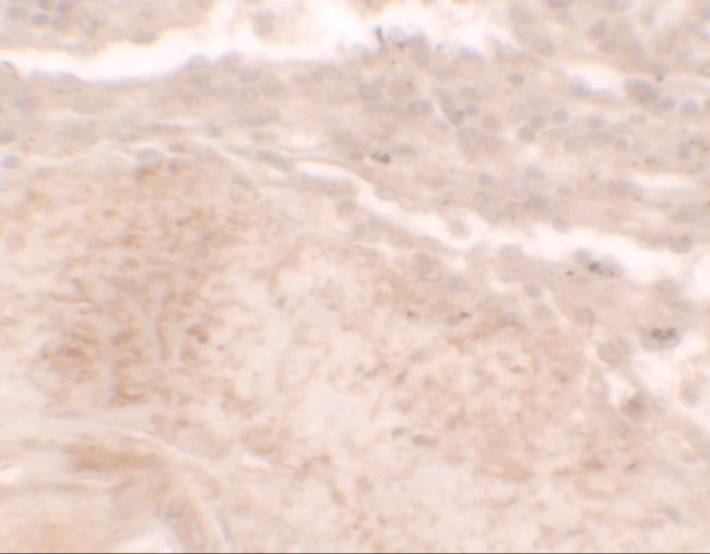 TLX3 Antibody in Immunohistochemistry (IHC)