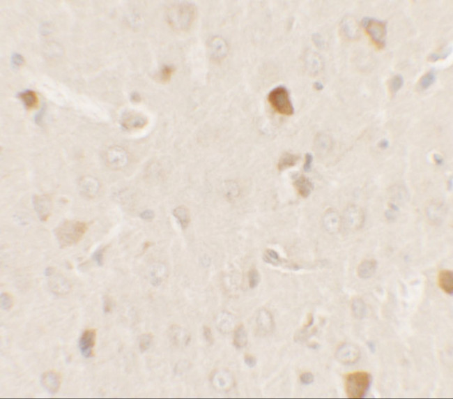 PRAS40 Antibody in Immunohistochemistry (IHC)