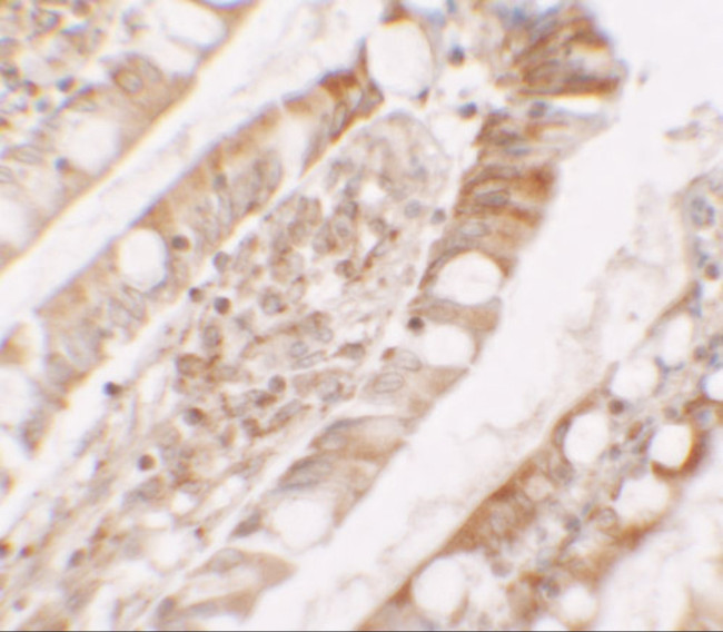 LPIN1 Antibody in Immunohistochemistry (IHC)