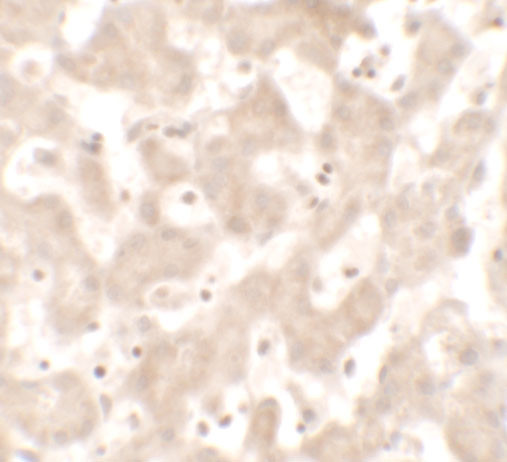 KHDC1 Antibody in Immunohistochemistry (IHC)