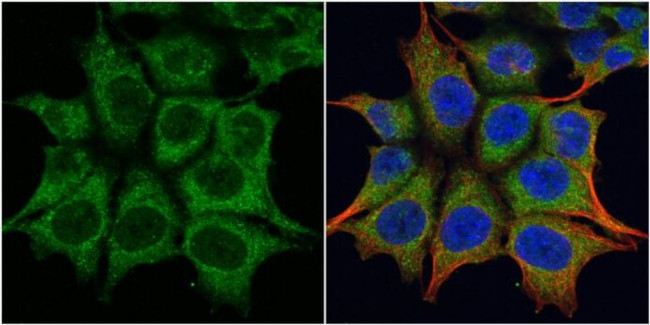 TRIM23 Antibody in Immunocytochemistry (ICC/IF)