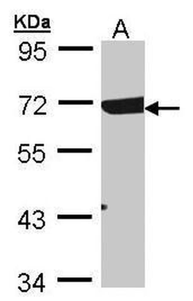 RAD17 Antibody in Western Blot (WB)