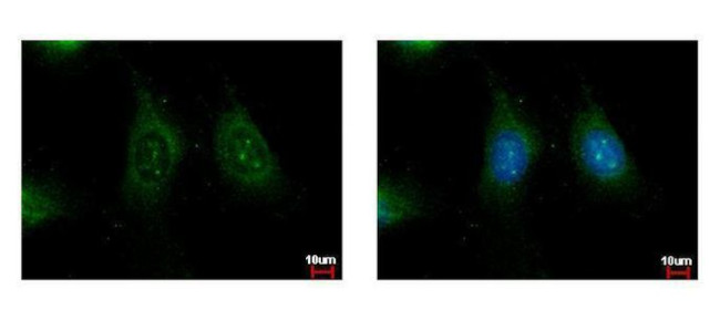 K-Ras Antibody in Immunocytochemistry (ICC/IF)