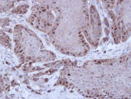 RAD51 Antibody in Immunohistochemistry (Paraffin) (IHC (P))