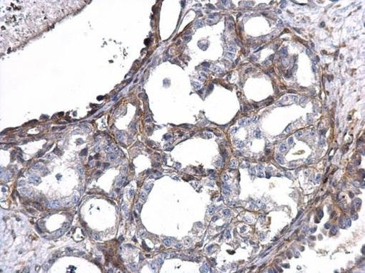 MMP14 Antibody in Immunohistochemistry (Paraffin) (IHC (P))