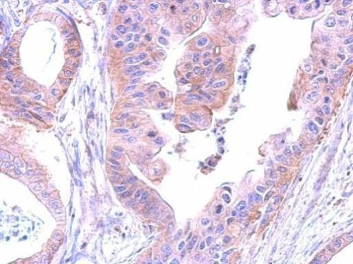 SHC Antibody in Immunohistochemistry (Paraffin) (IHC (P))