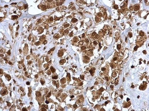 JAK2 Antibody in Immunohistochemistry (Paraffin) (IHC (P))