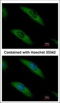Aldolase B Antibody in Immunocytochemistry (ICC/IF)