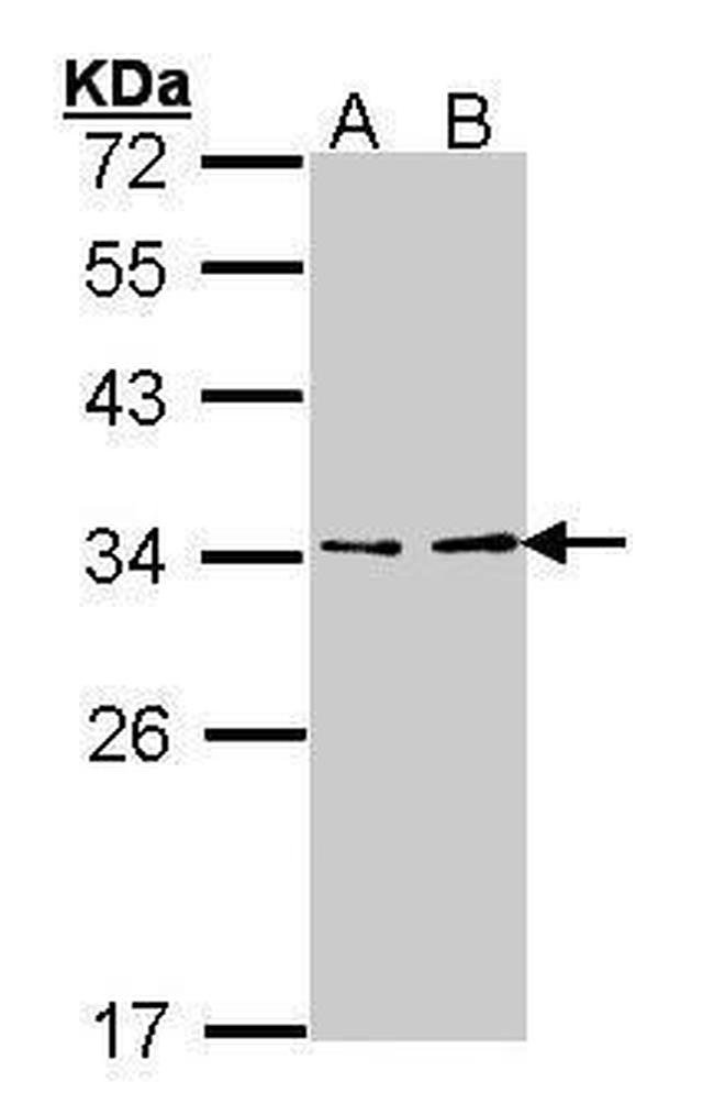 V-ATPase E1 Antibody in Western Blot (WB)