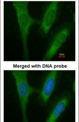 BAP31 Antibody in Immunocytochemistry (ICC/IF)
