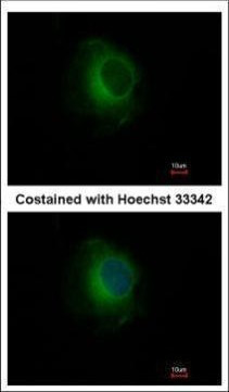 Plasminogen Antibody in Immunocytochemistry (ICC/IF)
