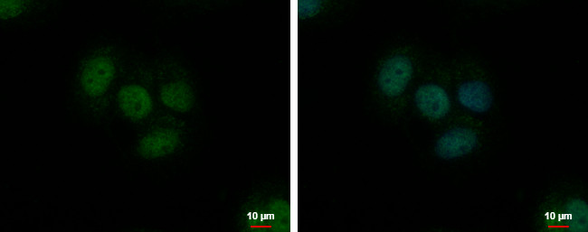 TrxR1 Antibody in Immunocytochemistry (ICC/IF)