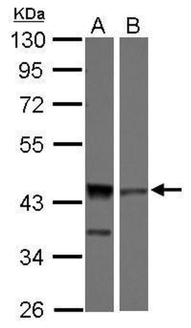 ICAD Antibody in Western Blot (WB)