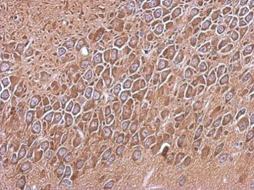 CD180 Antibody in Immunohistochemistry (Paraffin) (IHC (P))