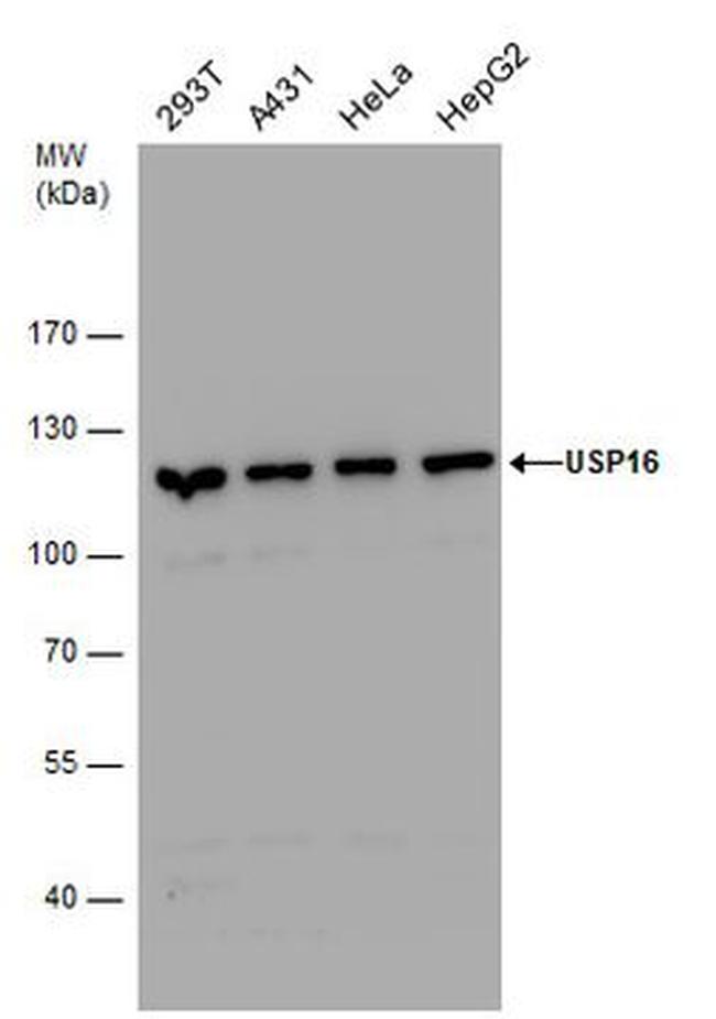 USP16 Antibody in Western Blot (WB)