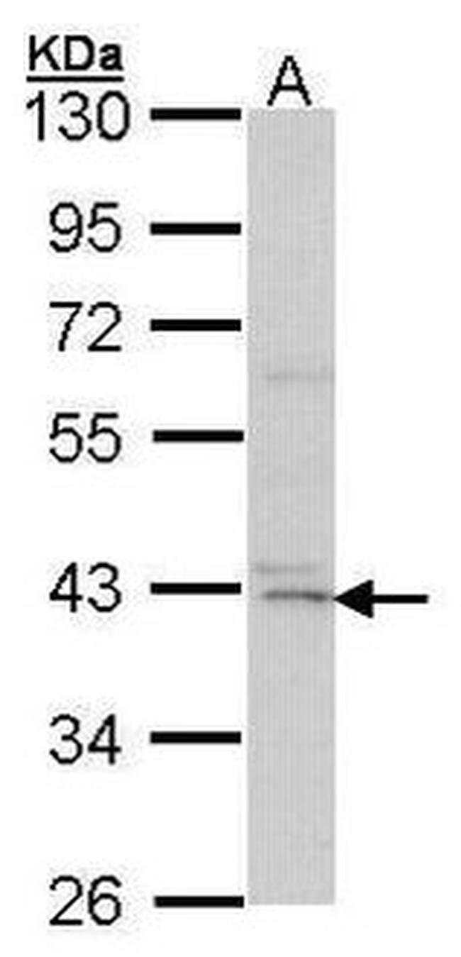 DAPK2 Antibody in Western Blot (WB)