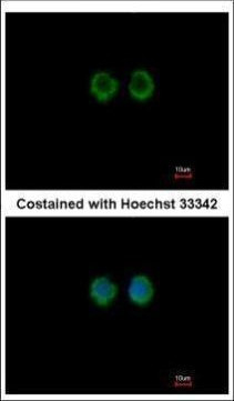 MOK Antibody in Immunocytochemistry (ICC/IF)