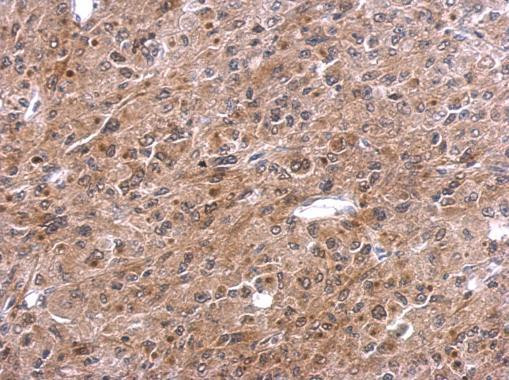 TNFAIP2 Antibody in Immunohistochemistry (Paraffin) (IHC (P))