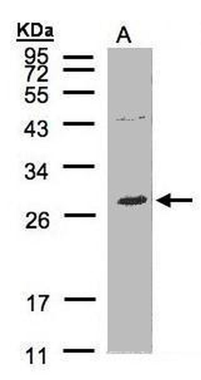 NTAL Antibody in Western Blot (WB)