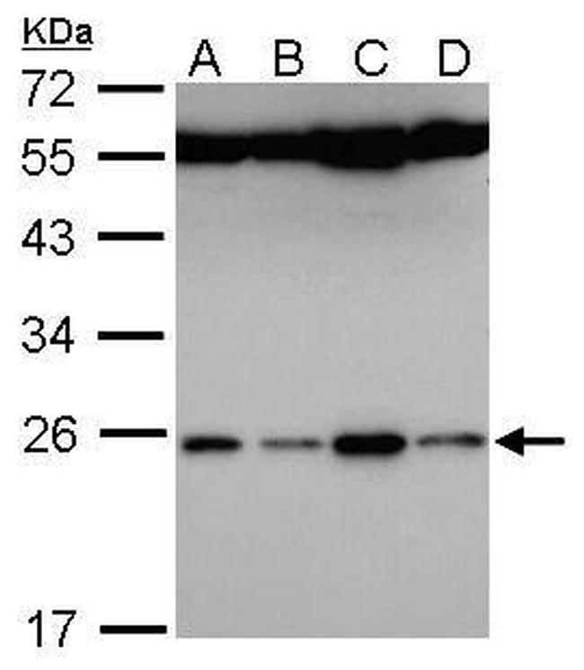 FAM9B Antibody in Western Blot (WB)
