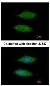 C11orf85 Antibody in Immunocytochemistry (ICC/IF)