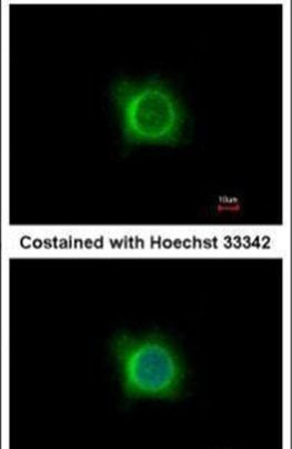PDK1 Antibody in Immunocytochemistry (ICC/IF)