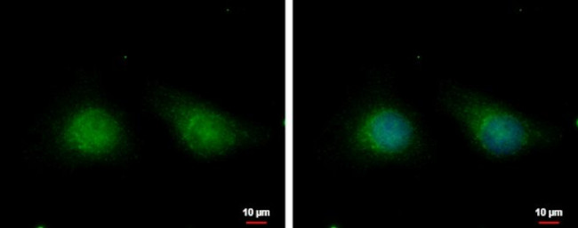 IP6K1 Antibody in Immunocytochemistry (ICC/IF)