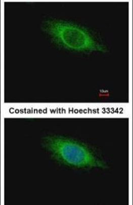VPS34 Antibody in Immunocytochemistry (ICC/IF)