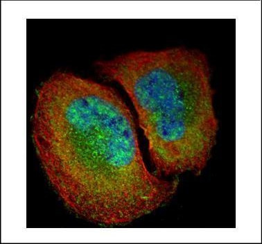 NFkB p65 Antibody in Immunocytochemistry (ICC/IF)