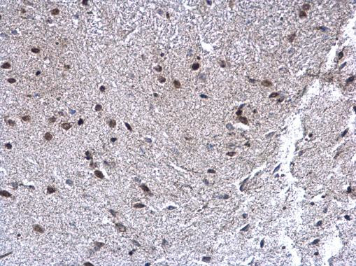SEPHS1 Antibody in Immunohistochemistry (Paraffin) (IHC (P))